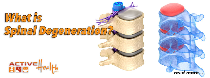 A Chiropractic Look at Spinal Degeneration