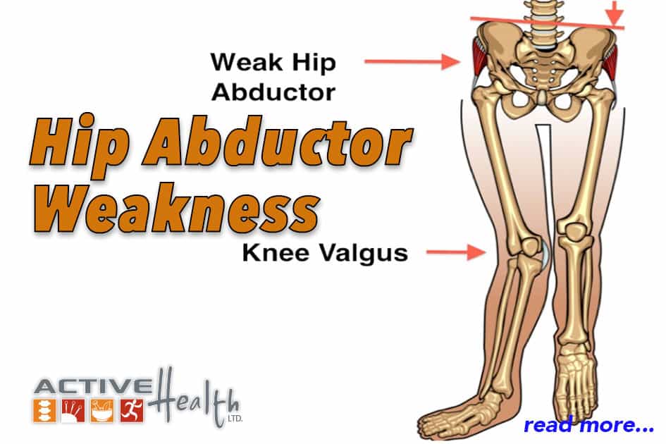 Condition of the Month – Hip Abductor Weakness - Chiropractor - Park ...