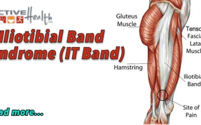 Iliotibial Band Syndrome (IT Band)