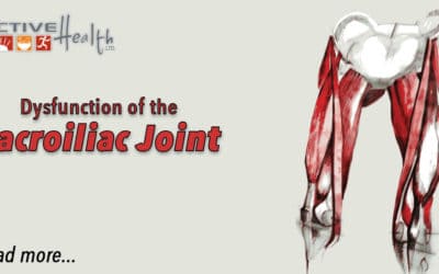 Condition of the Month: Sacroiliac Joint Dysfunction