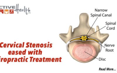 Condition of the Month – (Cervical Stenosis)