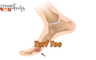 Condition of the Month – (Turf Toe)