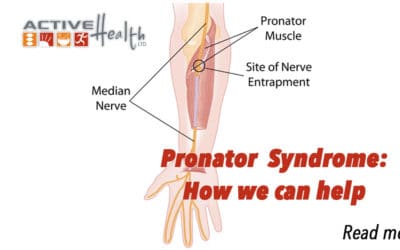 Pronator Syndrome