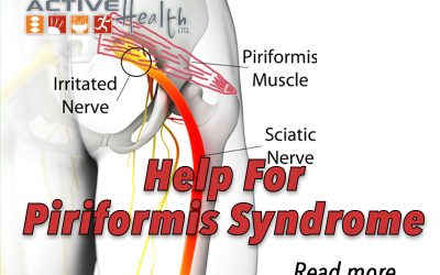 Piriformis Syndrome