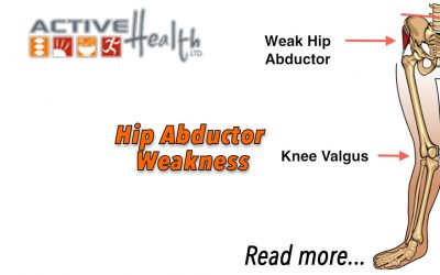 Hip Abductor Weakness