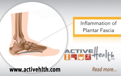 Pain In The Bottom Of Your Foot? It Could Be Plantar Fasciitis. ?