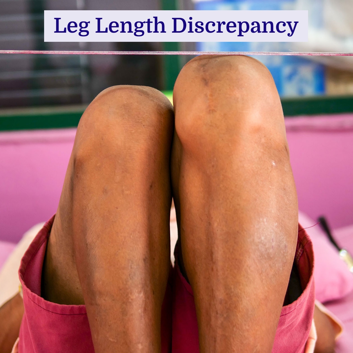 leg length back pain