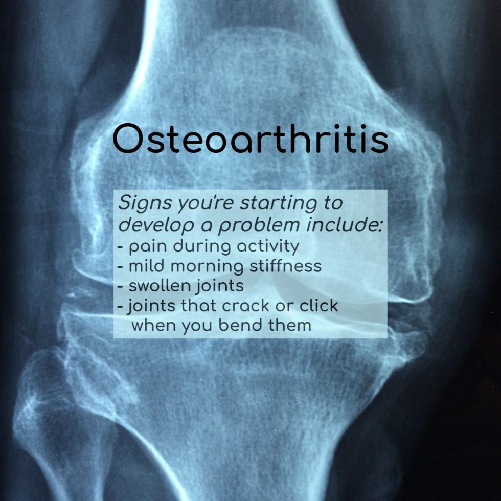 What is Osteoarthritis - Chiropractor - Park Ridge, IL - Active Health